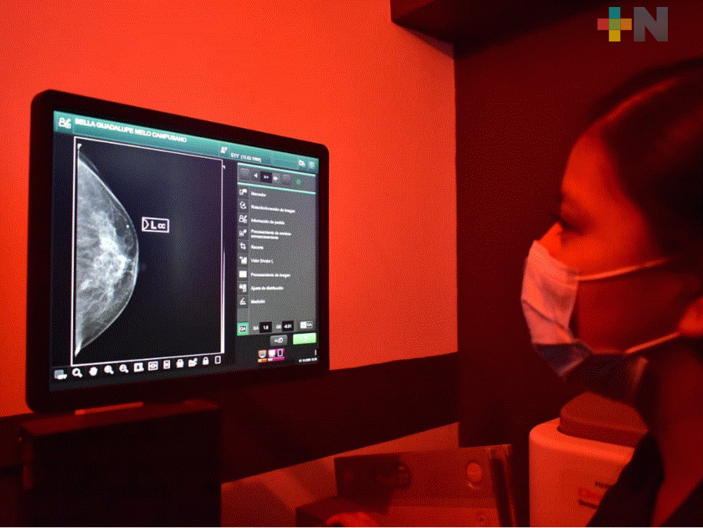 Sin costo alguno continúa campaña de mastografía en Tantoyuca; apoyan a pacientes vulnerables
