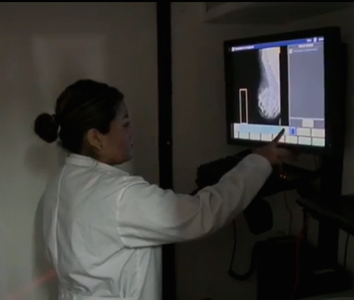 Asisten mujeres xalapeñas a jornada de mastografías gratuitas