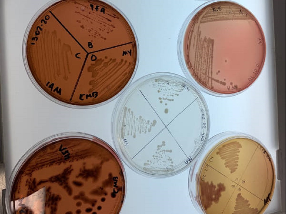 Descubre el IPN cómo recuperar suelos dañados por hidrocarburos