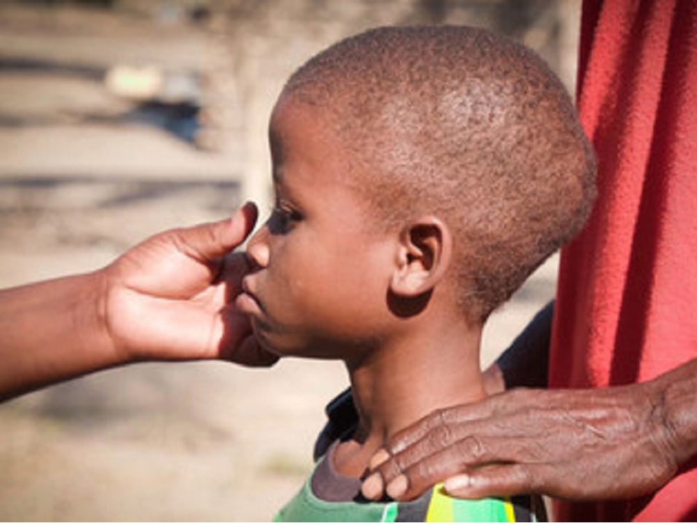 SIDA mató a casi 110.000 niños en 2019, 320.000 más se contagiaron de VIH