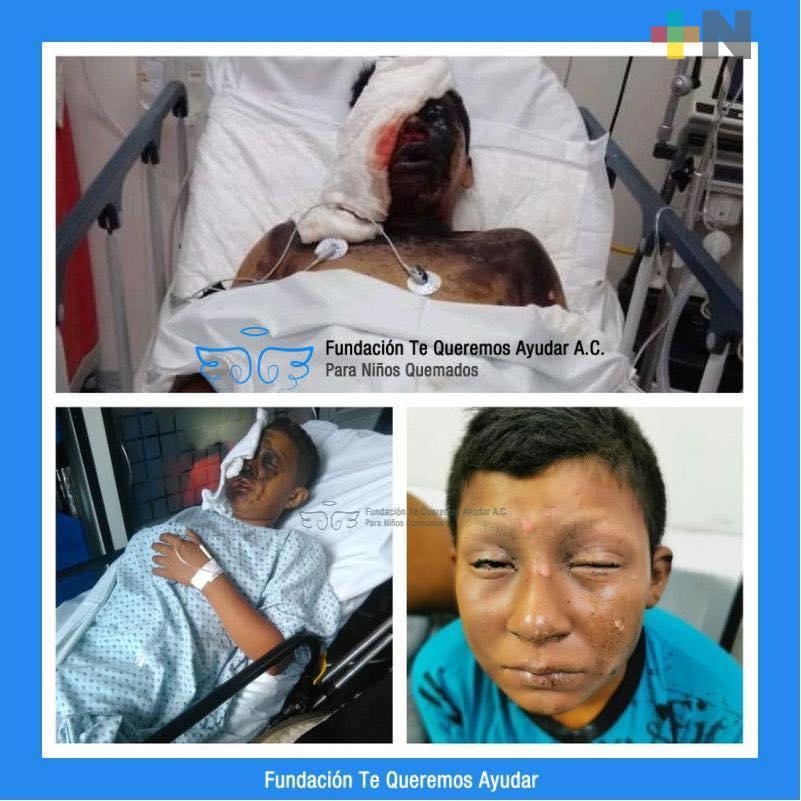 Cuatro personas de Coatzacoalcos en hospitales por quemaduras de cohetes
