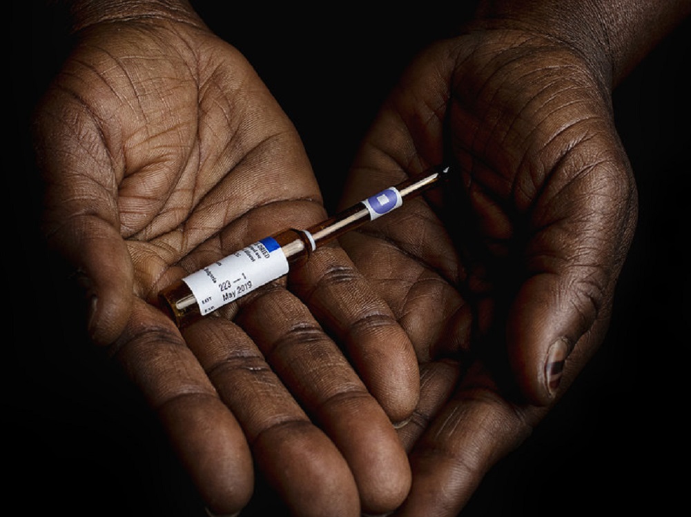 Detección de casos de tuberculosis en las Américas cae hasta un 20% por la pandemia