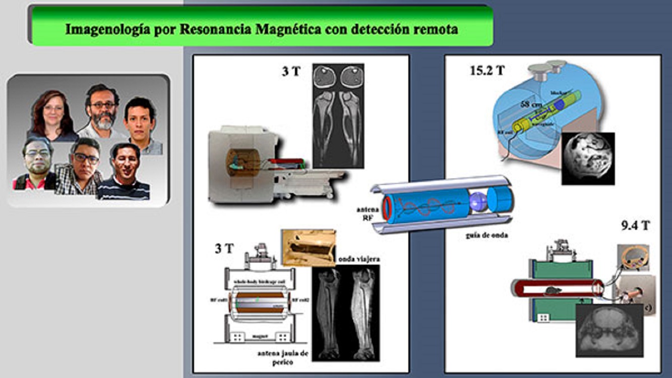 Diseñan en la UNAM nueva tecnología para lograr mejores imágenes por resonancia magnética