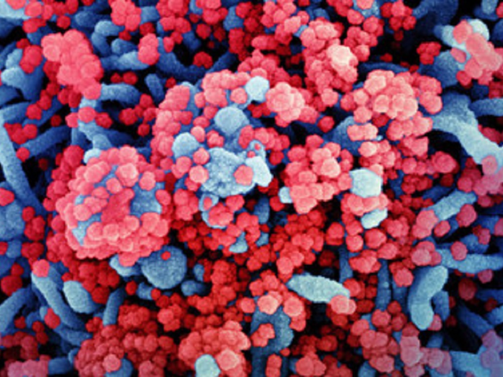 Variante de COVID-19 con origen en la India detectada en México no representa preocupación