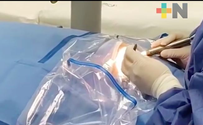 Jornada de Cirugía de Cataratas del IMSS benefició a 272 derechohabientes en el sur de Veracruz