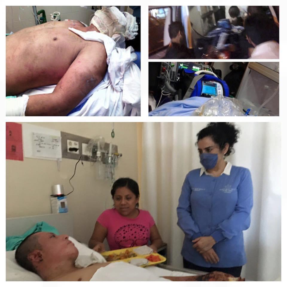 Recupera movilidad de manos tras cinco años de la explosión en Clorados III