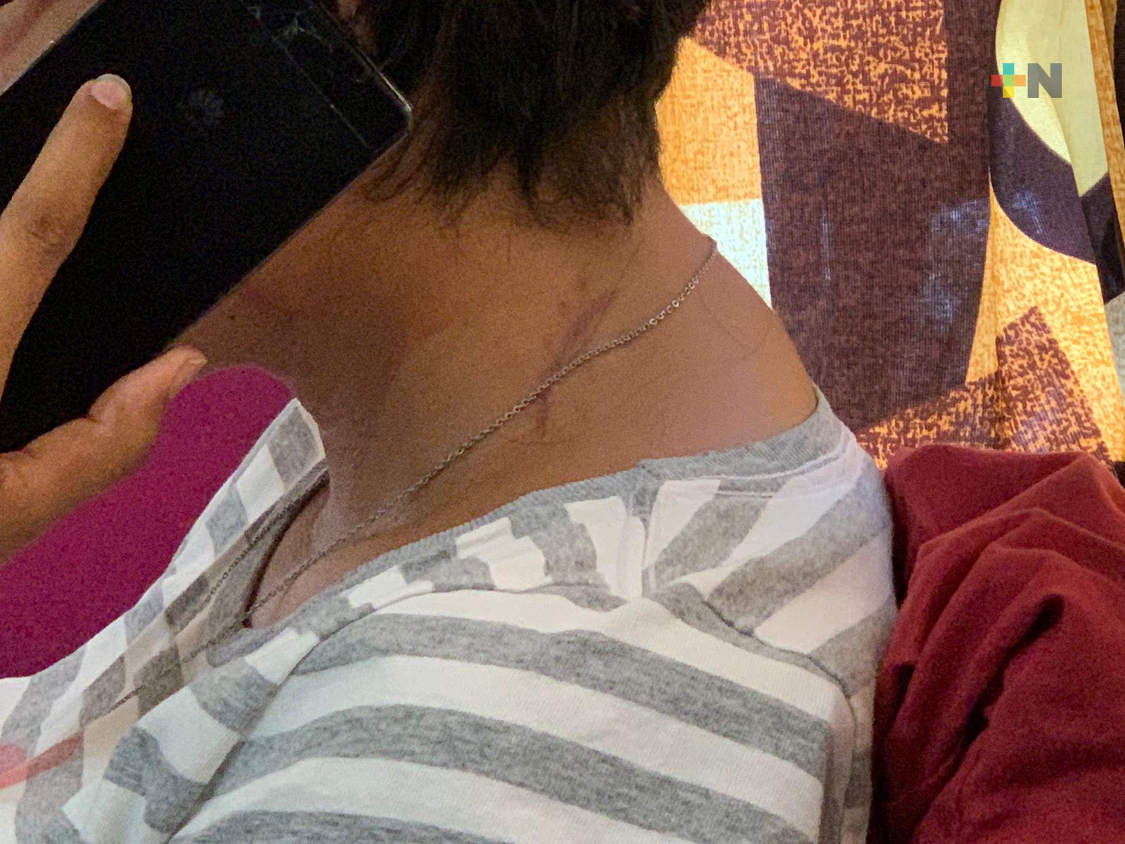 Joven agredida por su esposo en Coatzacoalcos, pide justicia y le dice a su agresor que se entregue