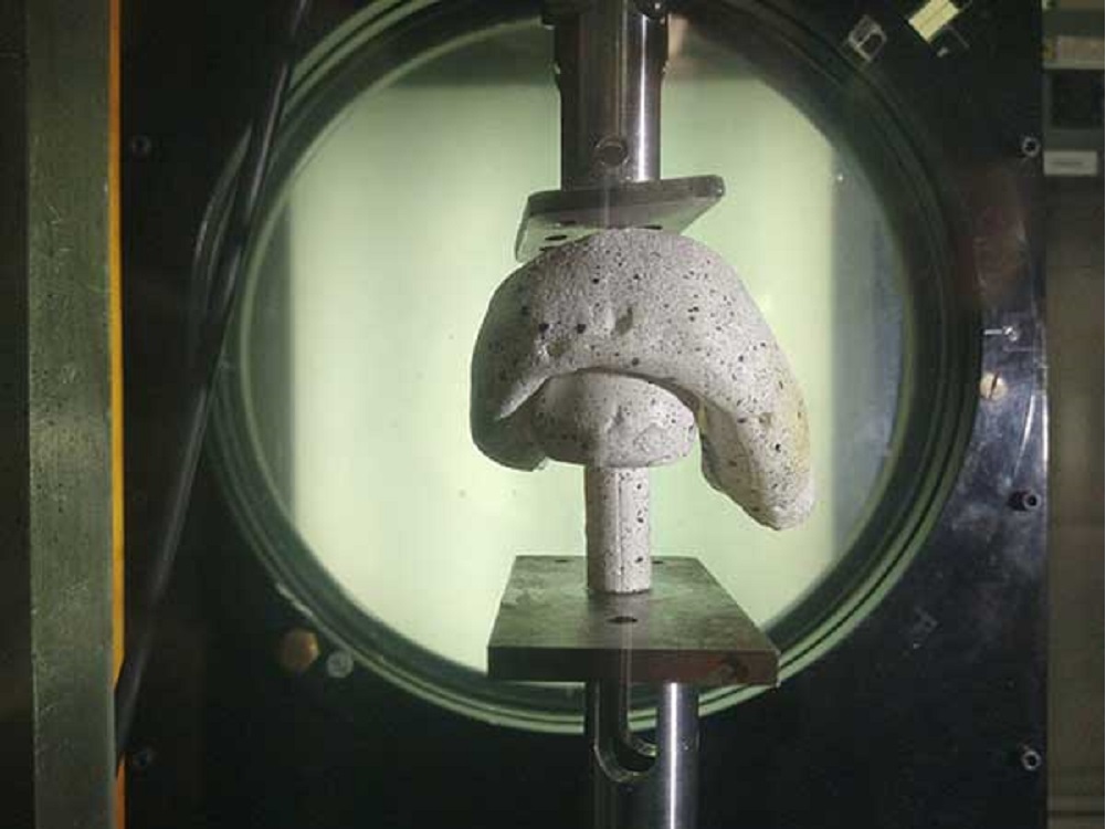 Desarrolla IPN prótesis de cadera única en su tipo