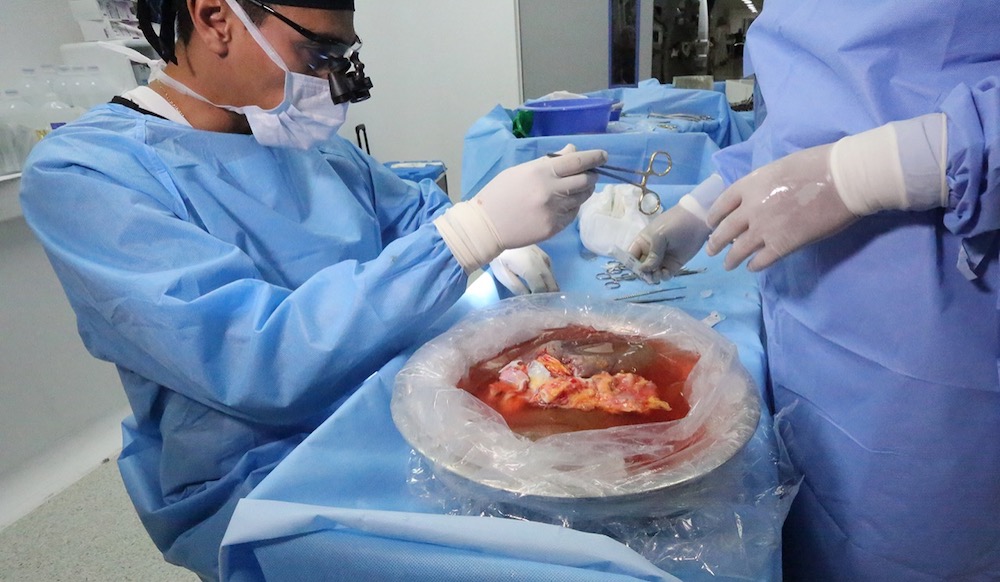 Más de 100 trasplantes realiza el ISSSTE durante la pandemia
