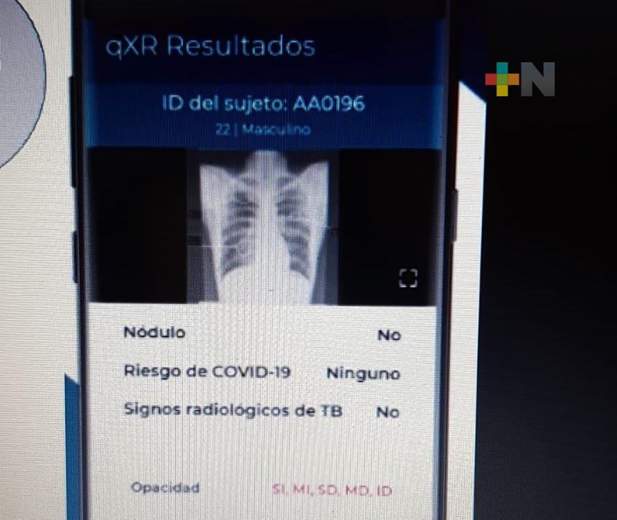 Con aplicación móvil, médicos se apoyan para  detectar cáncer de pulmón