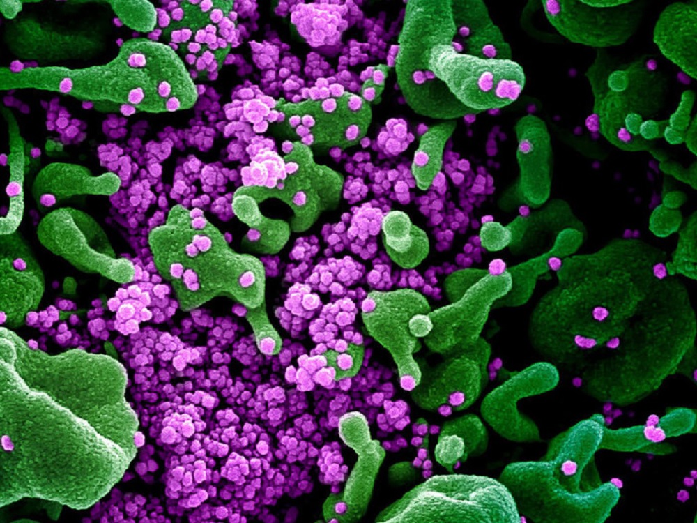 Variante Delta del COVID-19 ya está en África