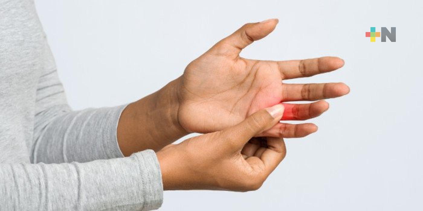 Sensibiliza IMSS Veracruz a población para conocer a tiempo los síntomas de artritis reumatoide