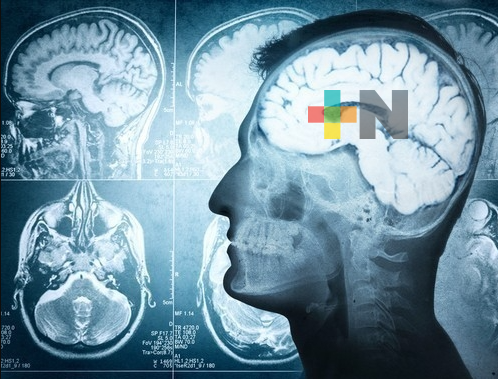 29 de octubre, Día Mundial del ICTUS