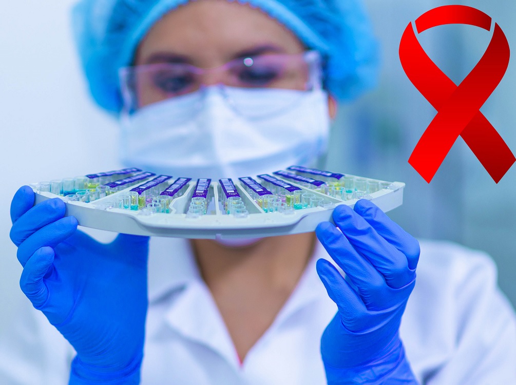 Descubren una variante más virulenta del VIH