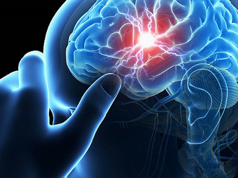 Identifican células que facilitan la recuperación por infarto cerebral