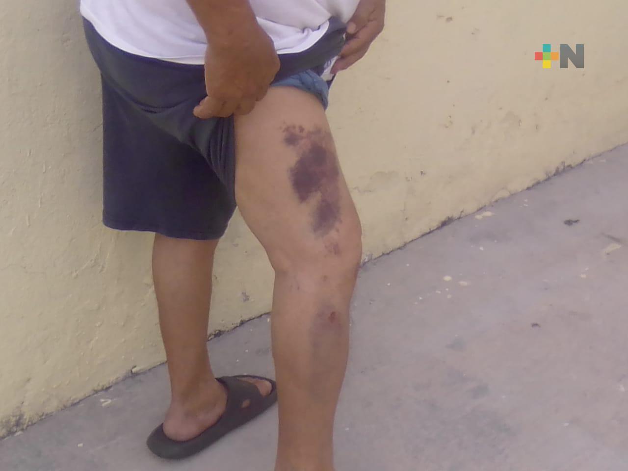 Otro ciudadano cae en tapa de registro mal colocada en Infonavit Chivería de Veracruz