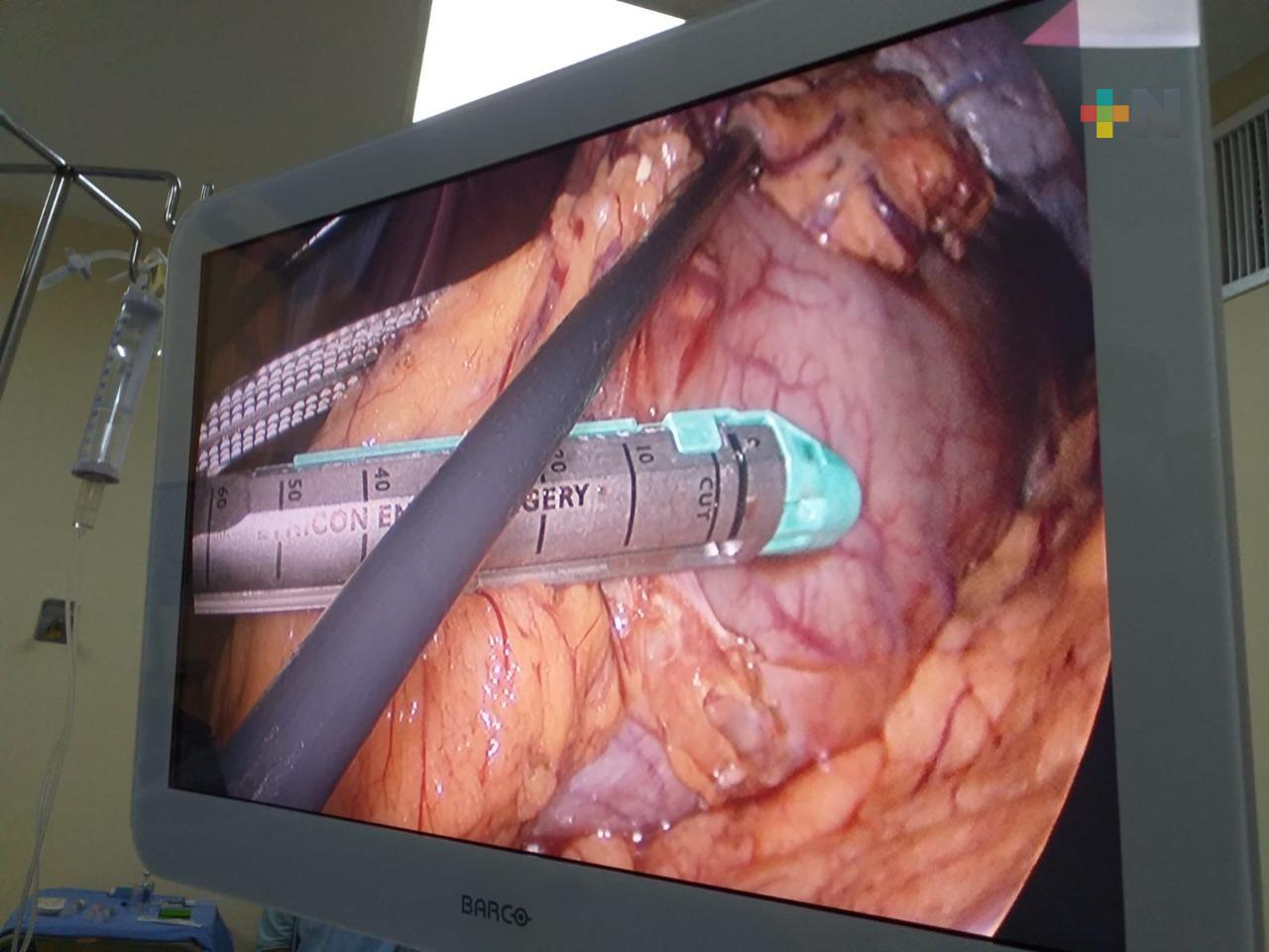En IMSS Veracruz realizan gastrectomía oncológica laparoscópica a paciente con Covid-19