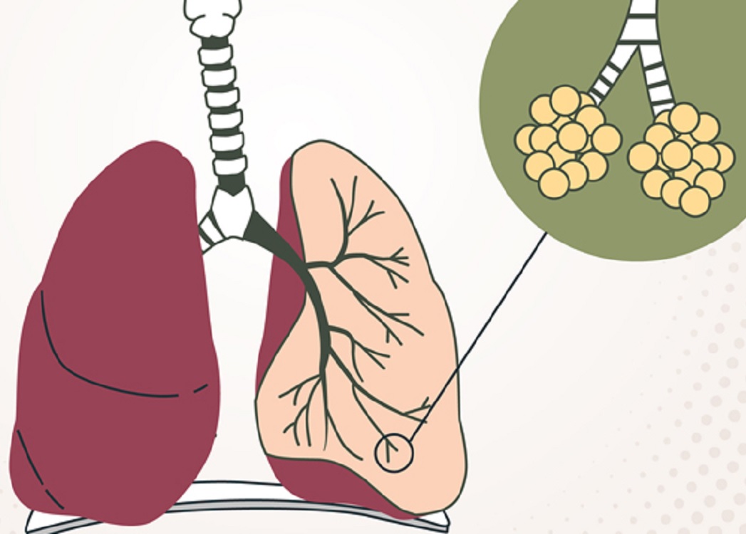El 23 de abril se conmemora el Día Nacional de la Fibrosis Quística