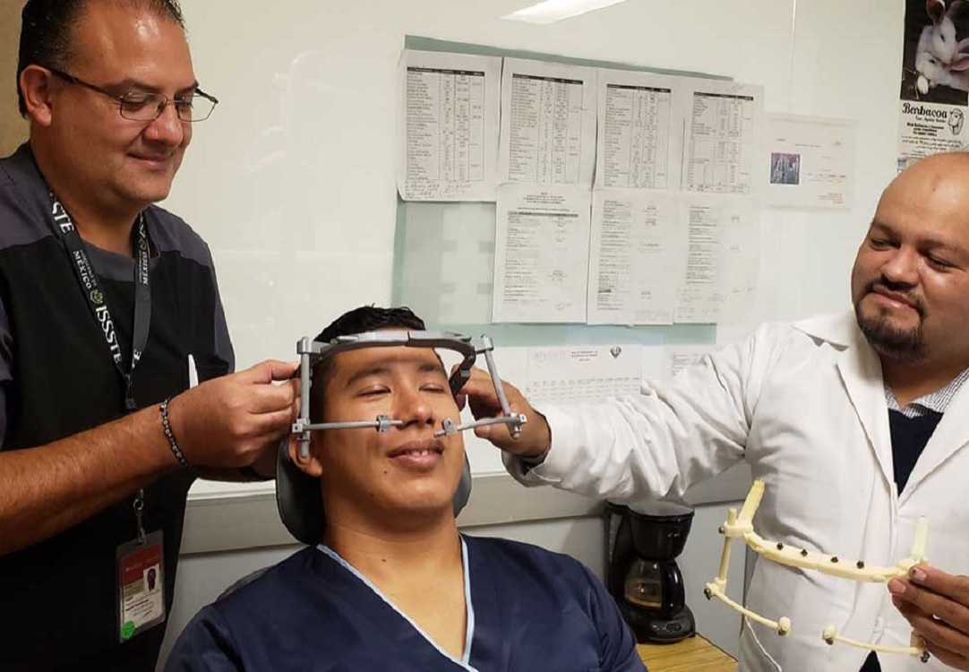 Unen esfuerzos ISSSTE e IPN para tratar pacientes con deformidades craneales