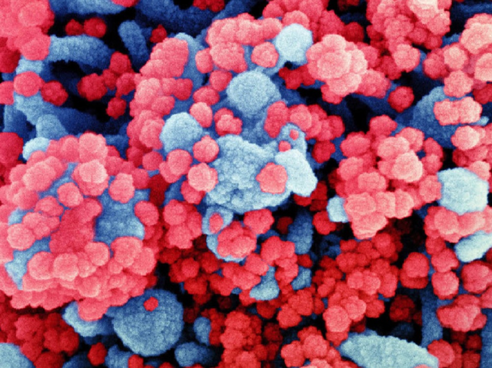 OMS no cree que ómicron vaya a ser la última variante del coronavirus