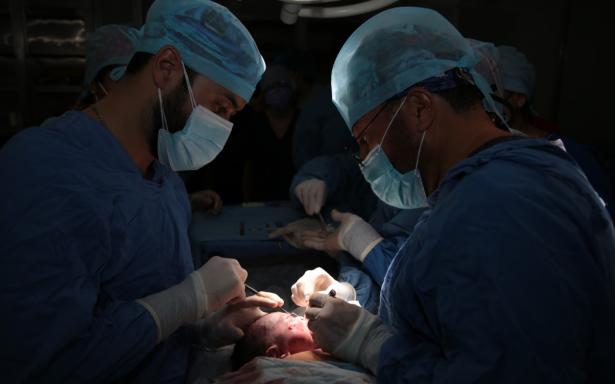 Especialistas del IMSS reconstruyen labio hendido a bebés mediante cirugía intraparto