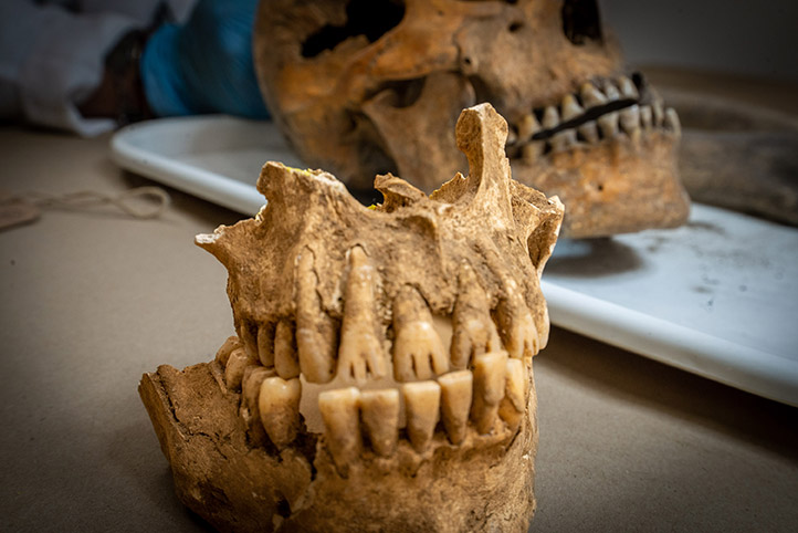 Modificación dental y sonrisa denotarían uso político del cuerpo