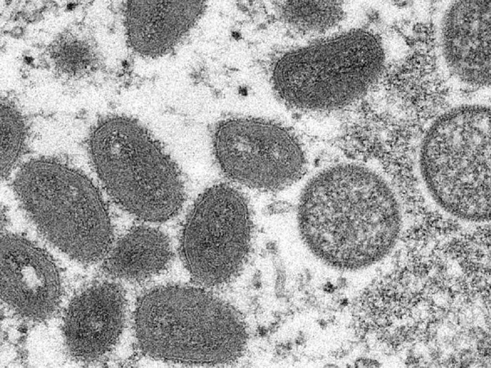 Secretaría de Salud amplía medidas preventivas contra la viruela símica