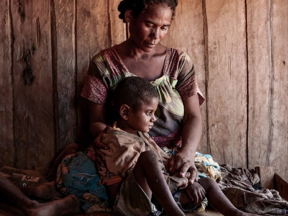 Menores de cinco años en 15 países afectados por crisis del hambre: UNICEF