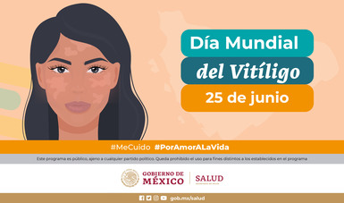 Importante dar enfoque integral a la atención del vitiligo