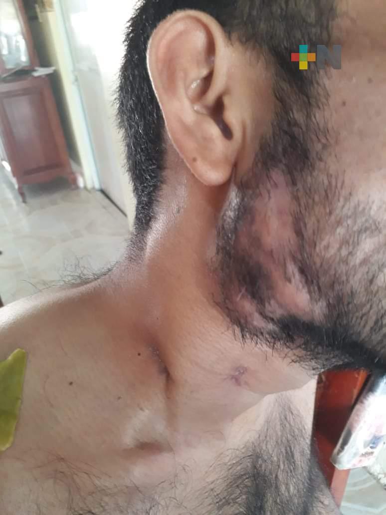 Pide apoyo económico joven de Agua Dulce diagnosticado con cáncer