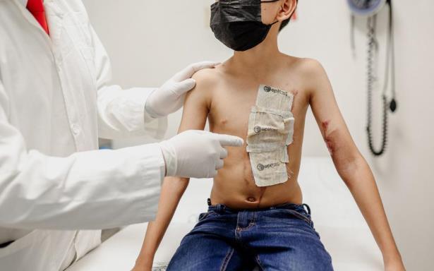 Con injerto de piel cultivada, IMSS Chiapas ayuda a recuperación de pacientes quemados