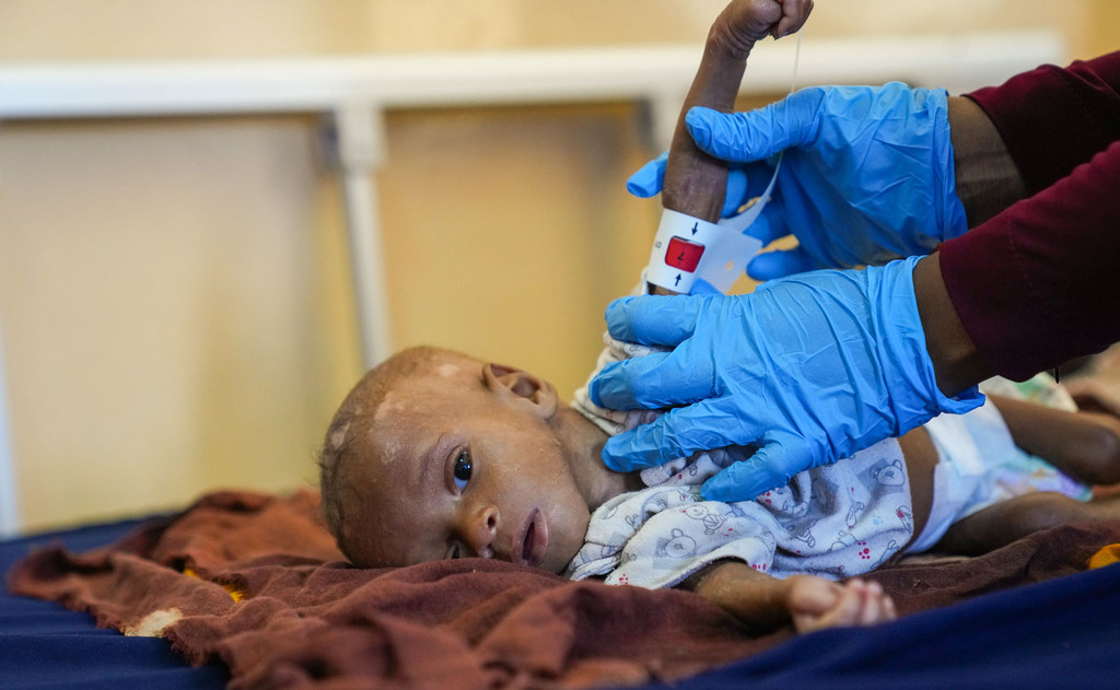 Cólera amenaza la vida de los niños desnutridos en Haití