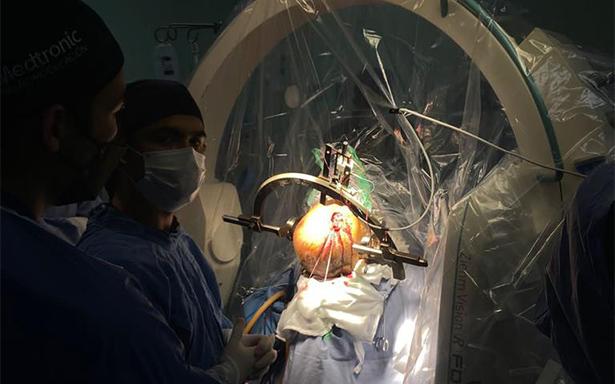 Colocan neuroestimulador cerebral para recuperar funcionalidad en paciente con Párkinson