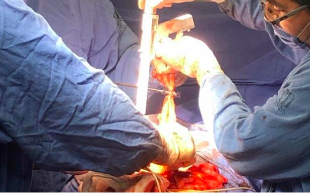 Reconstruyen médicos del IMSS en Veracruz abdomen de paciente de 34 años