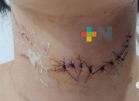 Joven denuncia en Instagram intento de feminicidio