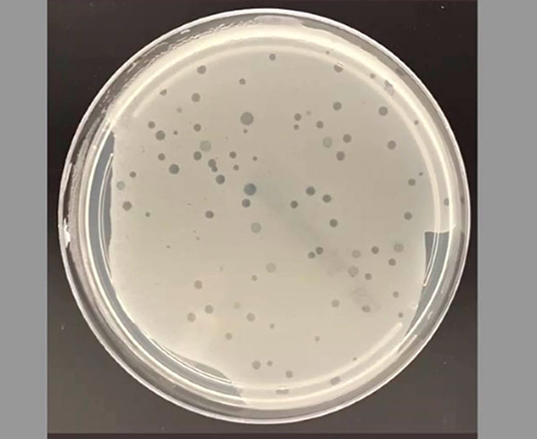 Con virus “depredadores” buscan combatir bacterias resistentes a los antibióticos
