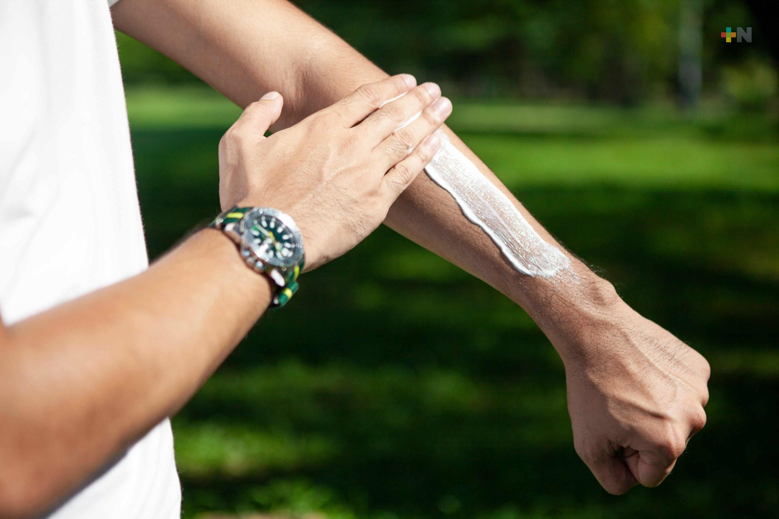 Recomienda IMSS Veracruz Norte prevenir quemaduras por sol