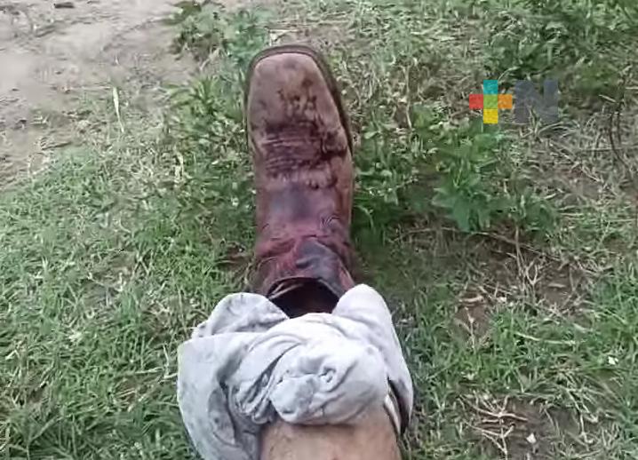 Ambientalista es trasladado al hospital tras ser mordido por jabalí en Antón Lizardo