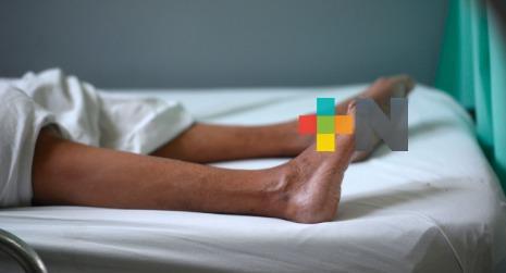 Casos esporádicos de síndrome de Guillain Barré en Veracruz