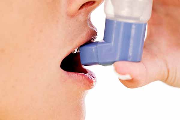 Mujeres tienen mayor prevalencia de presentar crisis asmáticas