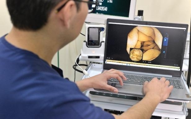 Cápsula endoscópica del IMSS graba interior del tubo digestivo para agilizar diagnósticos
