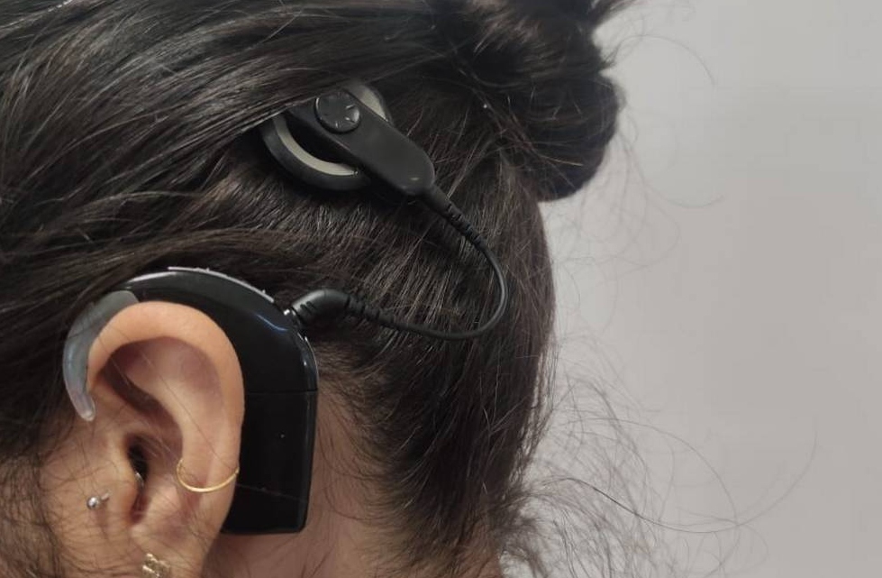 IMSS otorgará implantes cocleares a derechohabientes con discapacidad auditiva