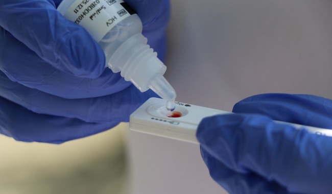 Invitan a acudir a realizarse la prueba de detección de hepatitis C