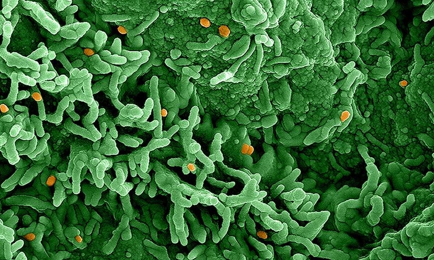 Comité Nacional para la Vigilancia Epidemiológica emite aviso por mpox