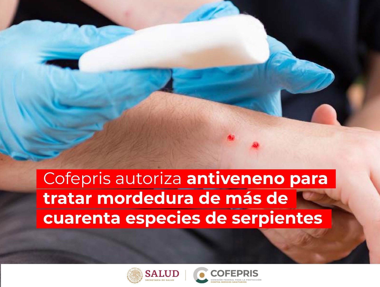 Cofepris autoriza antiveneno para tratar mordedura de más de 40 especies de serpientes