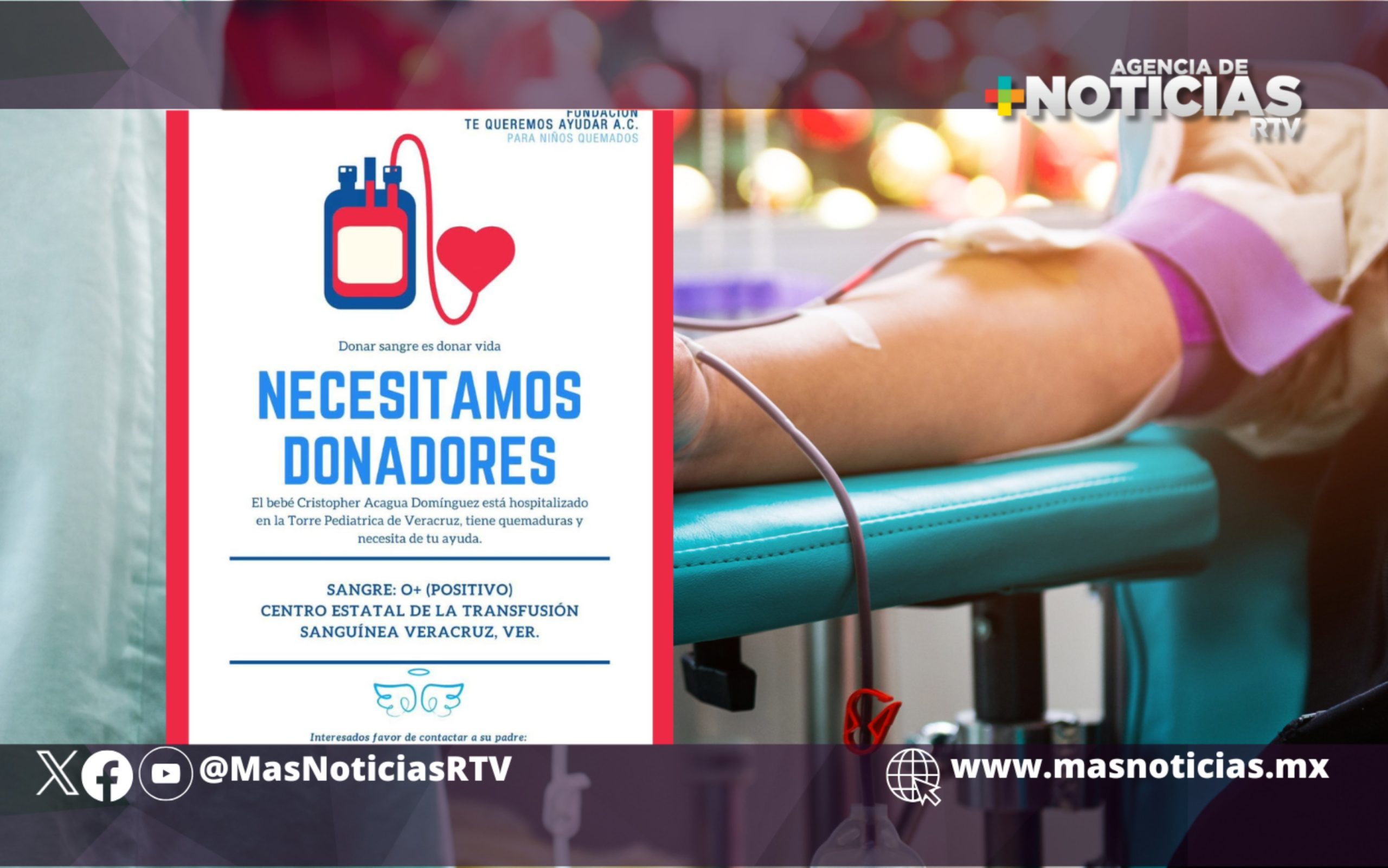 Piden donadores de sangre para bebé quemado de Minatitlán