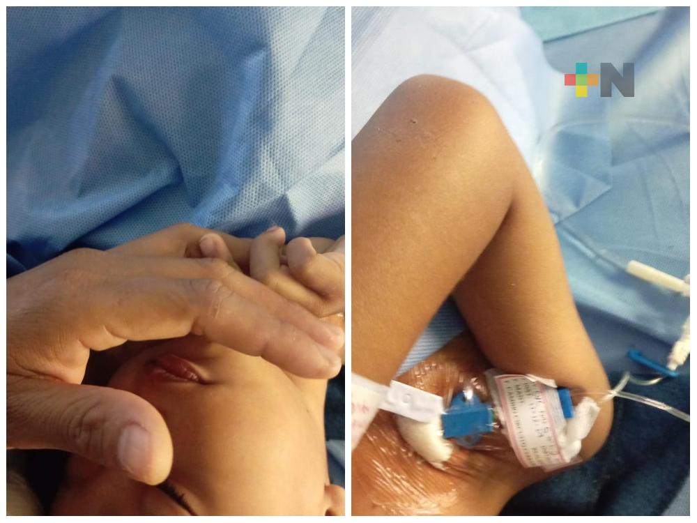 Dan de alta a niño quemado en Minatitlán