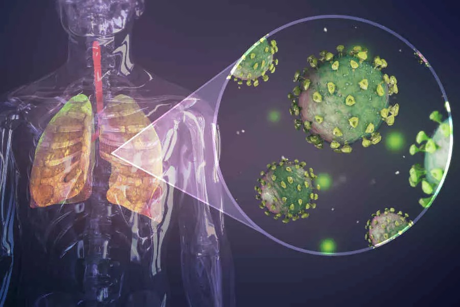 Importante seguir las recomendaciones para prevenir enfermedades respiratorias