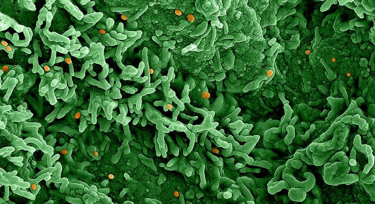Detectados casos de mpox en países que no habían sido afectados anteriormente