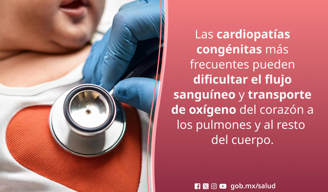Prevención y detección oportuna, claves para atender cardiopatías congénitas